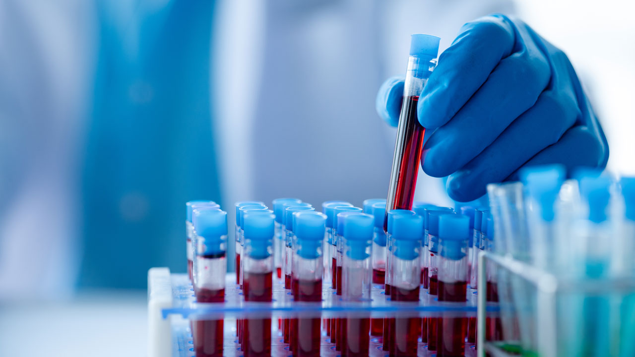 Technician sorting test tubes containing blood sample