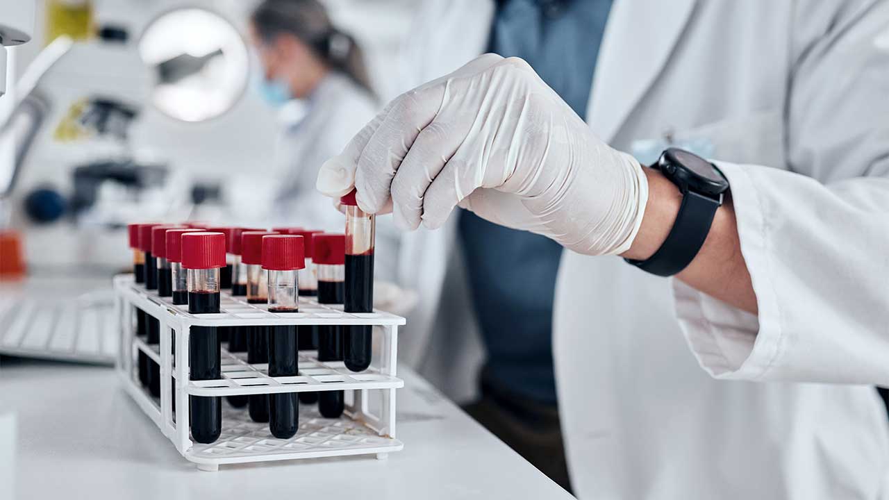 Laboratory worker putting a test tube into a rack of samples